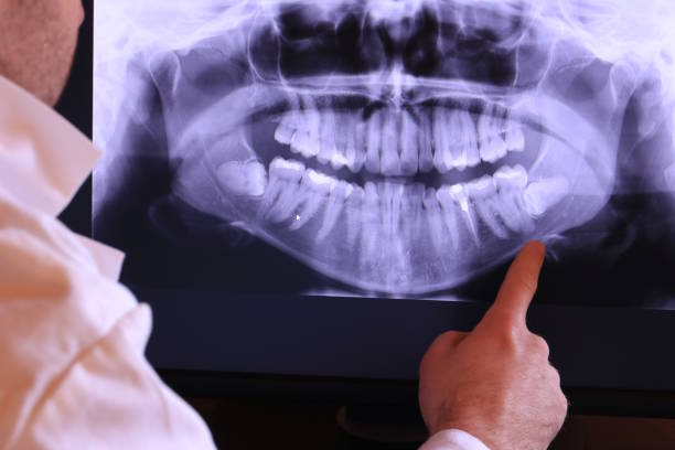 Best Emergency Treatment for Dental Infections or Abscesses in Crainvle, IL
